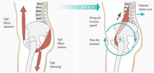 Muscle imbalance